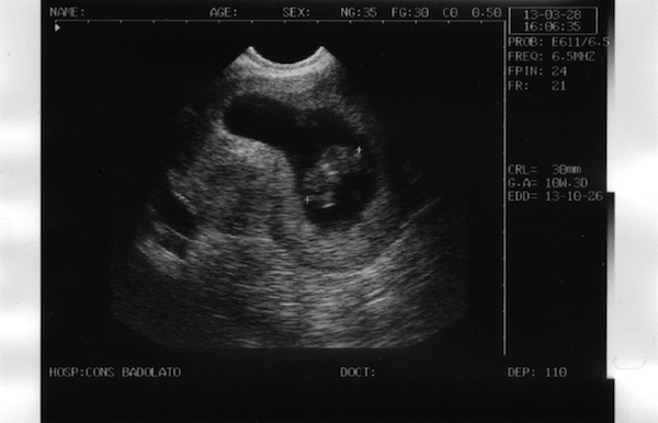 Baby Fabio - 10 weeks